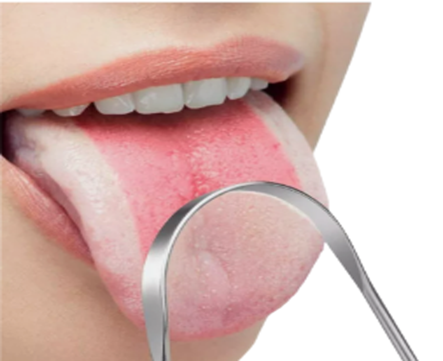 STAINLESS STEEL TONGUE SCRAPER